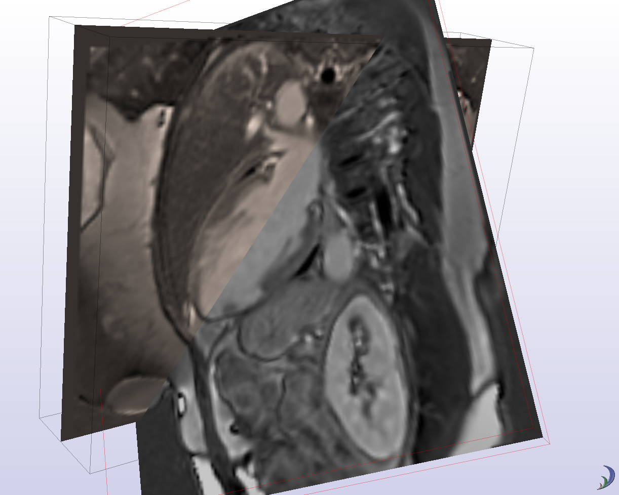 Consistent rotation/translation of medical images 